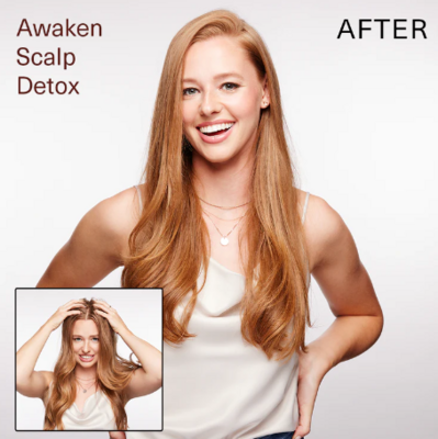 Awaken Scalp Detox